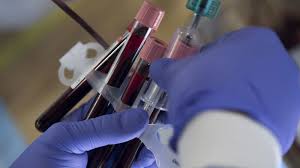 تسجيل 3 اصابات جديدة بفيروس كورونا في تونس