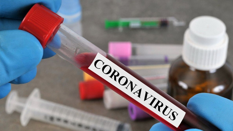 وزارة الصحة: لا وفيات جديدة بفيروس كورونا منذ 19 أفريل
