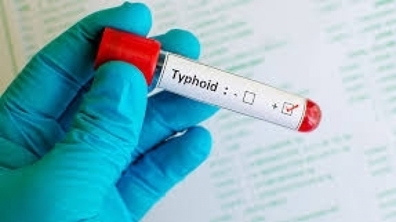 مدير الصحة بتطاوين: ارتفاع عدد الإصابات بالحمى التيفية إلى 130 حالة
