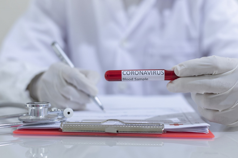 وزارة الصحّة: 148 إصابة جديدة بفيروس كورونا